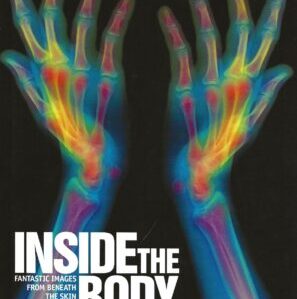 Inside the Body: Fantastic Images from Beneath the Skin (Hardback)